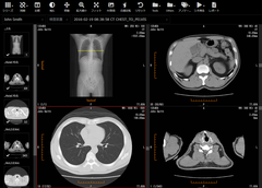 医療機器認証を取得した医療画像管理システム『SonicDICOM(R) PACS MD』の提供を開始