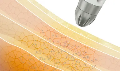 メカニズム：Step3