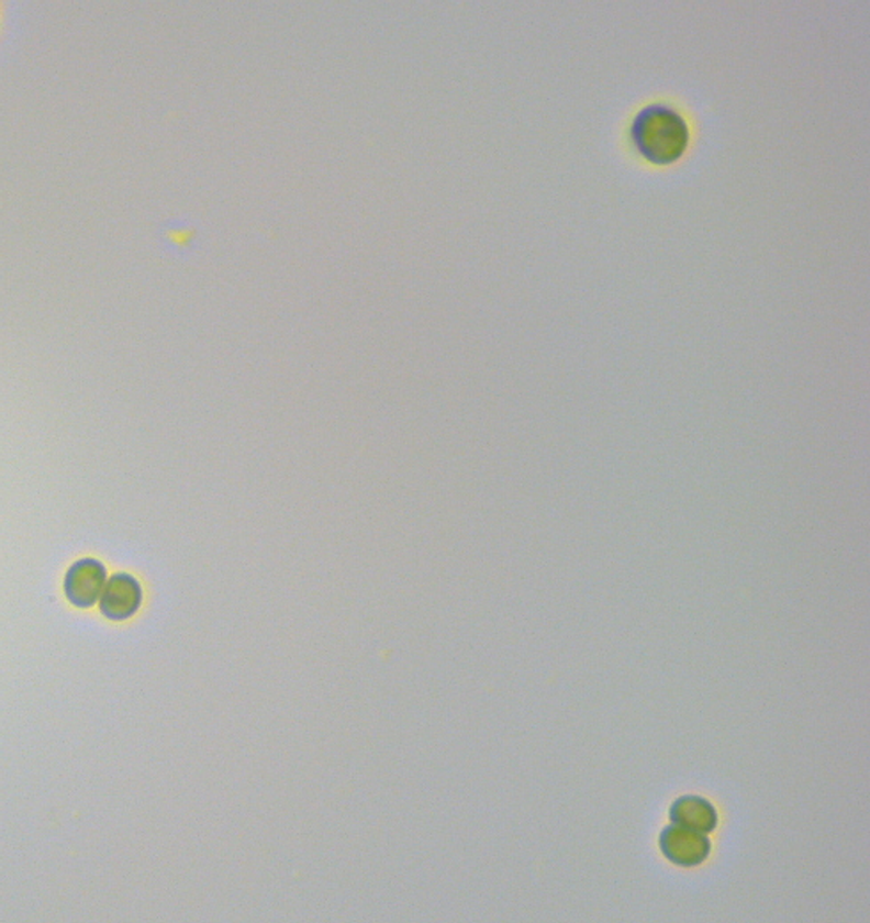 クエン酸回路の流れに著しく逆行する酵素の発見