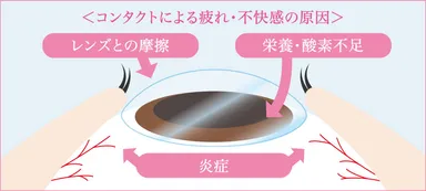 図 コンタクトレンズ装用時の疲れ・不快感の原因(イメージ)