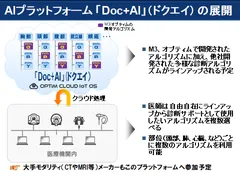 AIプラットフォーム「Doc＋AI」(ドクエイ)の展開
