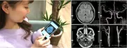 「スマート脳ドック」の特徴