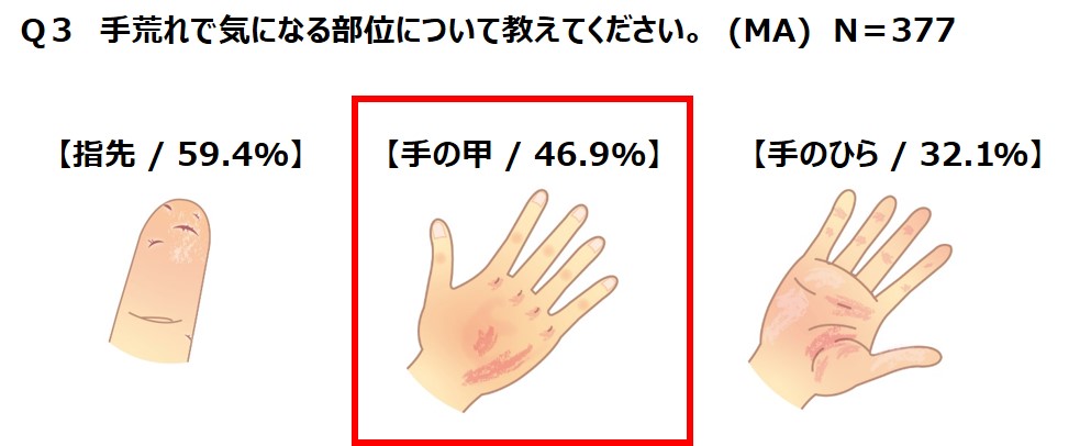 主婦500名に聞いた 冬の手荒れに関する意識調査 発表 手荒れ ケア難民 続出 正しいケアをできていない人は8割も 株式会社池田模範堂のプレスリリース