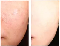 02 ミントグリーン　ビフォーアフター