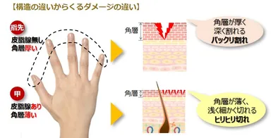 指先と手の甲の構造の違い