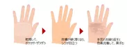 手肌の変化
