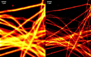 左：光学顕微鏡画像　右：超解像顕微鏡画像