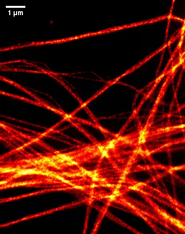 図3:超解像顕微鏡画像