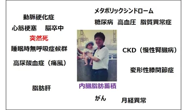 様々な病気につながる内臓脂肪蓄積