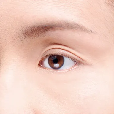 写真C(まぶたがくぼんだ40代女性の目元)