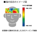 脳の反応のイメージ図