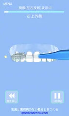 歯磨き貯金ヨコ磨き