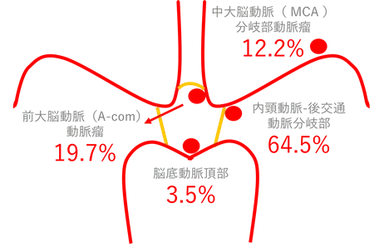 脳動脈瘤発見部位