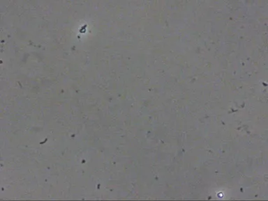 歯周病菌　処置後