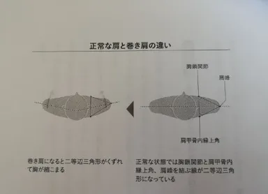横の肩甲骨ラインの弯曲