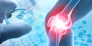 変形性ひざ関節症の痛みが幹細胞治療で約30スコア低下　～世界初の研究結果、国内3,000万人の患者に明るい可能性～