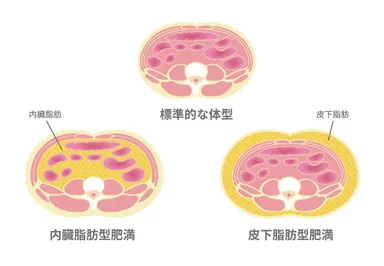 脂肪の付き方