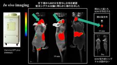 唾液腺、脳に影響を与える臓器であると判明　唾液中の脳由来神経栄養因子が、抗不安作用を示すと発表