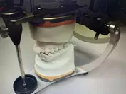 歯科版人間ドック(診断用模型作成)