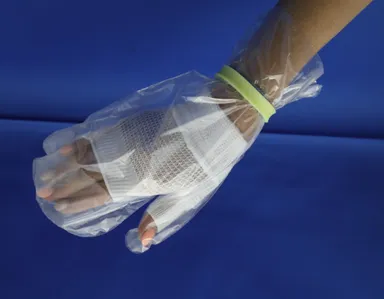 お助けミトングローブ　装着