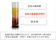 自分の血液を使った細胞治療　APS療法導入施設数 販売開始から約1年間で「100施設」を突破