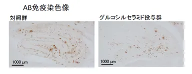 ＜アミロイドβペプチド斑の減少＞※グルコシルセラミド投与群では、発症原因の一つとされるアミロイドβペプチドが減少していることが確認された
