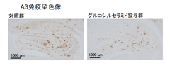 こんにゃくセラミドの摂取によるアルツハイマー病の発症予防効果を確認