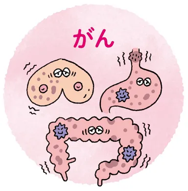 がん　イメージ