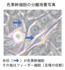 ヒトの皮膚から色素幹細胞の分離培養技術を確立！～これまで困難であった色素異常の発症メカニズムの解明に期待～