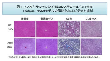 図1：AXはCL含有lipotoxic NASHモデルの脂肪化および炎症を抑制