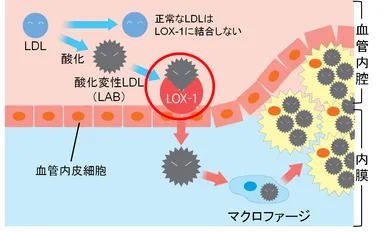 図4　動脈硬化の進行メカニズムとLOX-index(R)