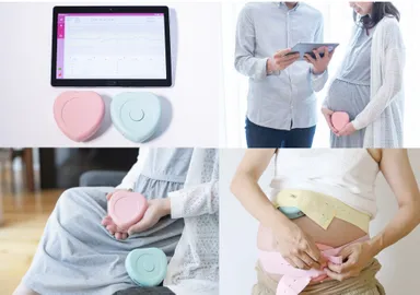 分娩監視装置iCTG