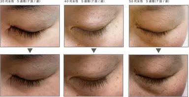 ノンニードル・アイラッシュ メソッドの有用性試験結果(一部抜粋)