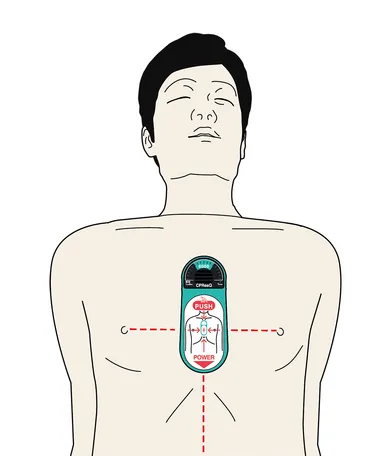「シーピーレスキュー(CPResQ)」ご使用イメージ1