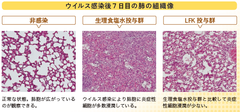 乳酸菌がウイルス性肺炎を抑制、免疫力の向上にも有効　～北海道大学との共同研究により酵素処理乳酸菌素材LFKで肺炎抑制効果を確認、特許取得済～