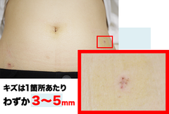 img_215110_3.png