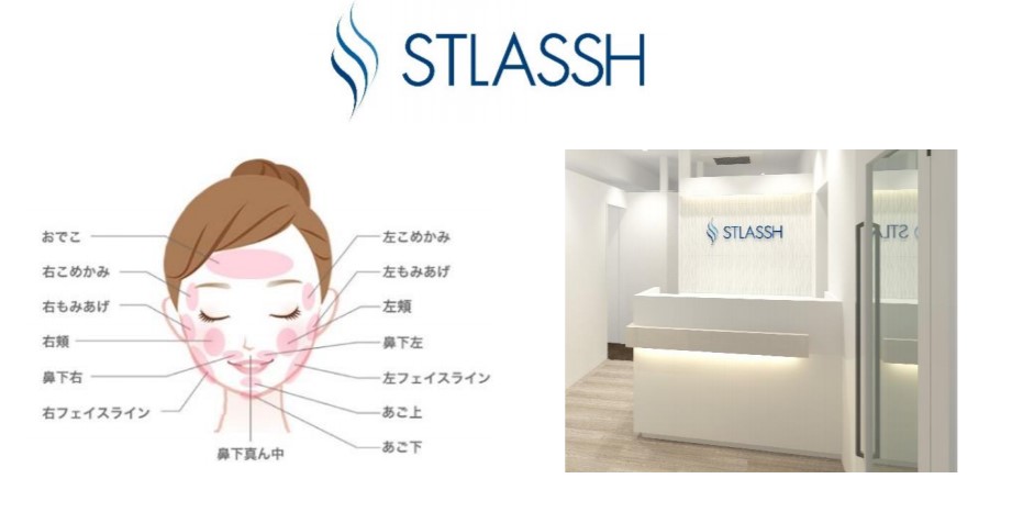 ラッシュ コロナ スト ストラッシュ脱毛の保証期間・有効期限一覧※無制限も期限有！延長方法