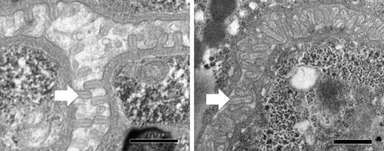 図4. マツ細胞食ステージの萎縮した腸微絨毛（左）と菌食ステージの発達した腸微絨毛（右）の電子顕微鏡像。白い矢印は腸微絨毛のひとつを示している。スケールバーは500 nm。
