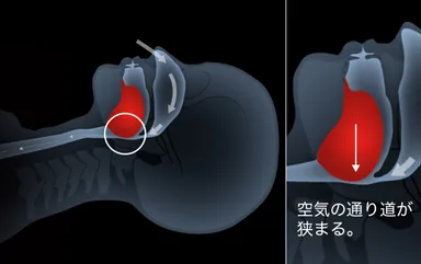 仰向け寝構造イメージ