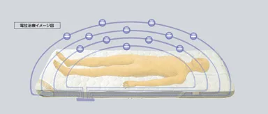 電位治療のイメージ