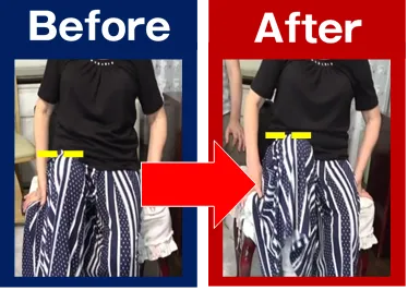 実際に施術を受けた、10年来の脊柱管狭窄症の患者様