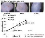 露地栽培アガリクス(KA21株)の手術後の早期回復効果について学会発表