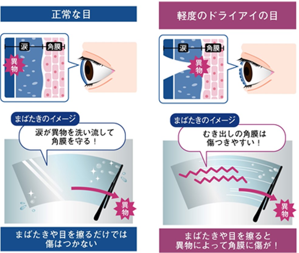 年は ヒエヒエのカラッカラな 寒乾 カンカン 天気 乾燥季節はお肌だけじゃなく目にも厳しい 今こそはじめたい角膜ケア習慣を紹介 現代人の角膜ケア研究室のプレスリリース