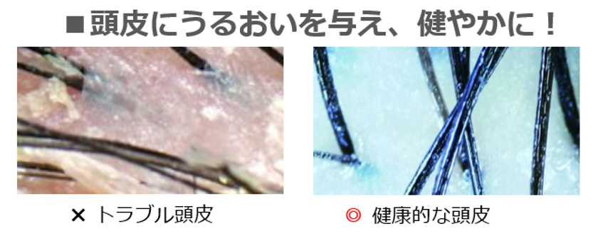 秋から始めたい頭皮ケア ダメージヘアにも育毛剤の新常識に関する情報を公開 株式会社ヤマサキのプレスリリース 秋から始めたい頭皮ケア ダメージヘアにも育毛剤の新常識に関する情報を公開 株式会社ヤマサキのプレスリリース