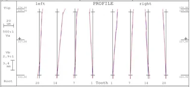 歯形レポート例