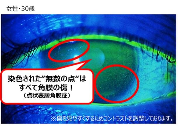 目のケアは潤すだけではない 角膜の傷をケアする時代へ 目を酷使している人の73 が角膜に傷がついていた 角膜の傷 リスクがわかるチェックリスト 角膜ケア方法を紹介 現代人の角膜ケア研究室のプレスリリース