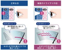 ～目のケアは潤すだけではない。角膜の傷をケアする時代へ。～目を酷使している人の73％が角膜に傷がついていた！角膜の傷リスクがわかるチェックリスト＆角膜ケア方法を紹介