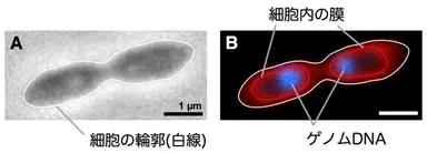 図2_RT761株の細胞に局在するゲノムDNA