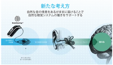 脳に音の情景の全体像を届ける補聴器