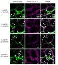 図2　各栄養条件下のシロイヌナアズナ葉の細胞におけるオートファジックボディー（用語4）形成の 共焦点顕微鏡観察